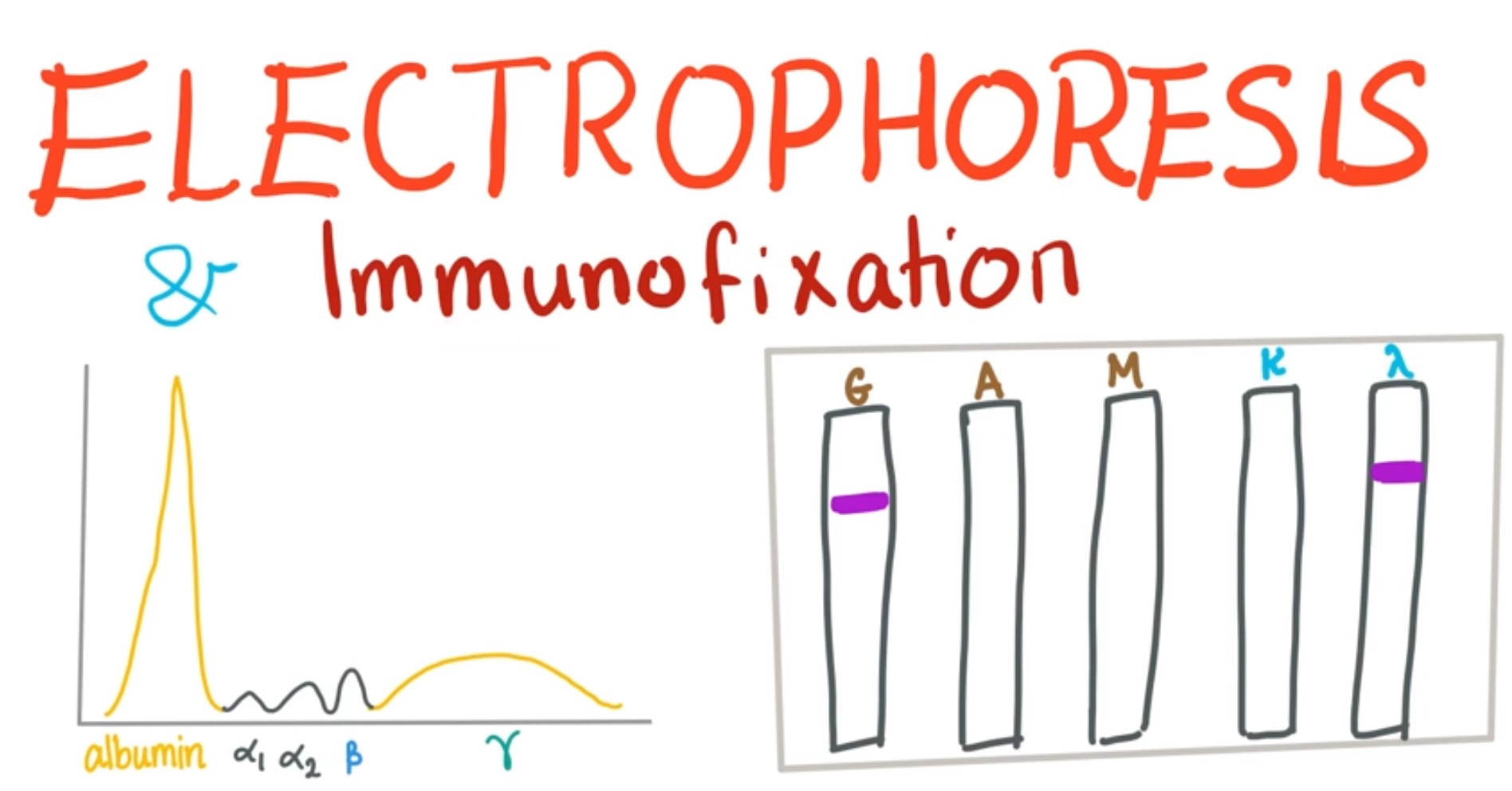 Serum Protein Electrophoresis And Immunofixation