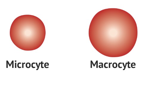 Difference Between Microcytic And Macrocytic Anemia