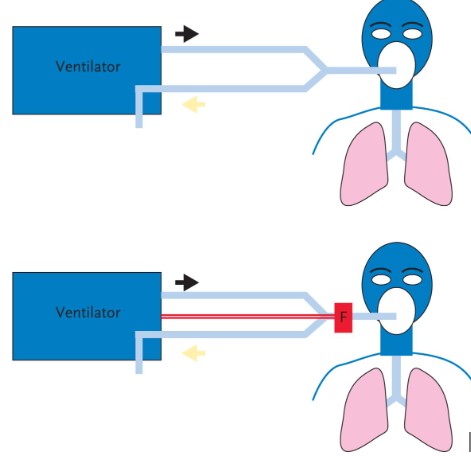 Difference Between Respirator And Vs Ventilator