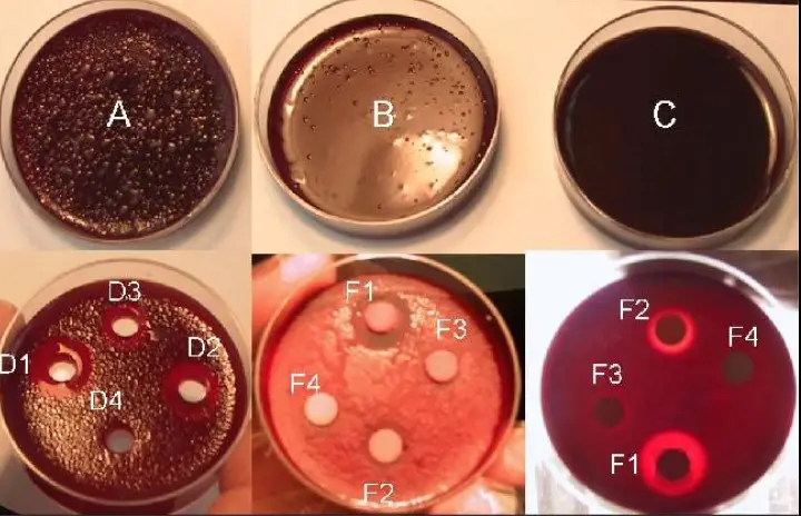 Comparison of agar well and disc diffusion methods